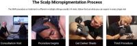 Jonathan Gerow Scalp Micropigmentation image 15